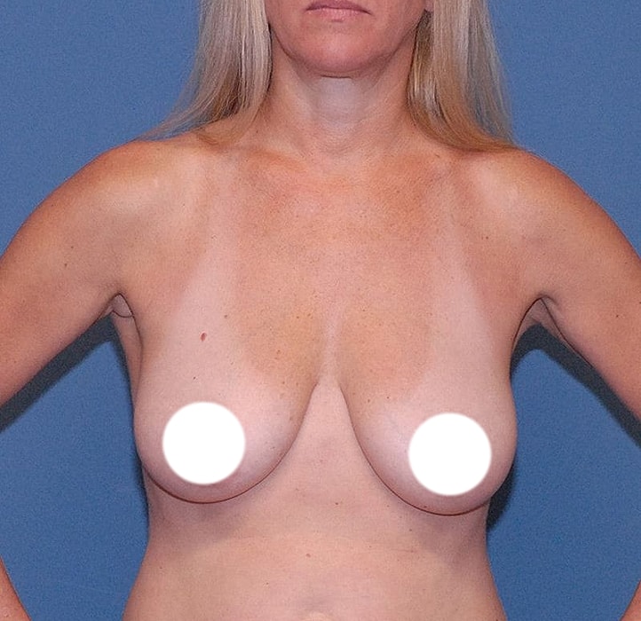 Nude woman posing against blue background.