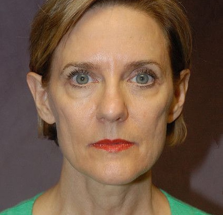 Portrait of a woman with neutral expression.