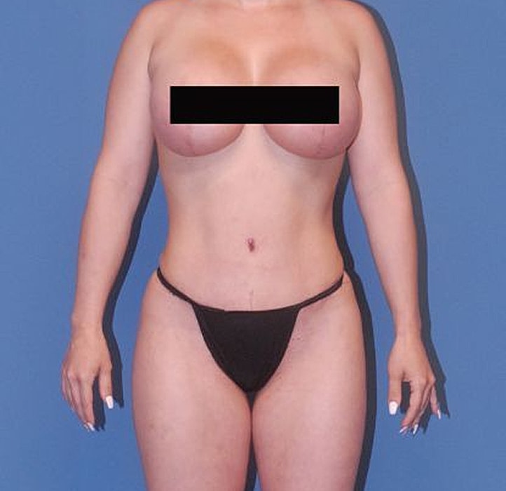 Model posing in black swimwear against blue backdrop.