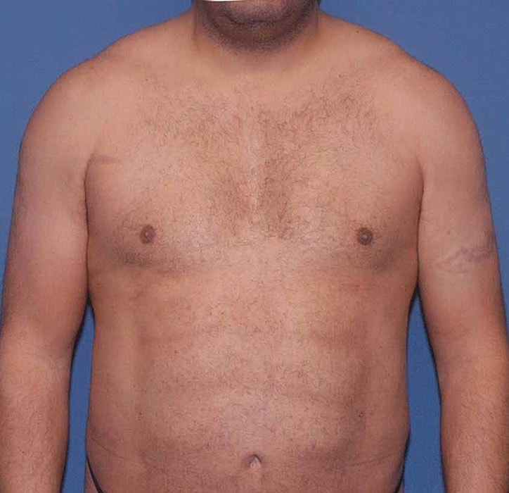 Male torso against a blue background.