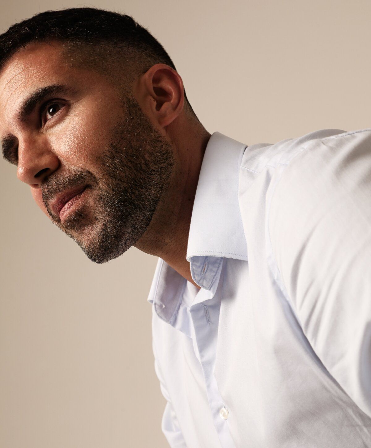 Hair transplant model posing in stylish casual outfit against wall.