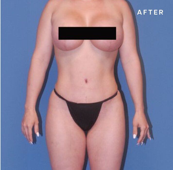 Before and after body transformation image.