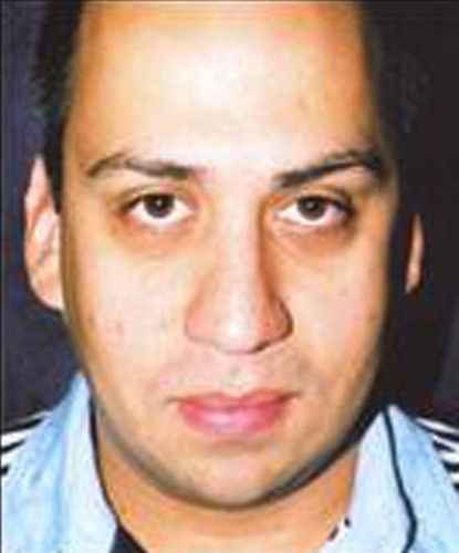 Male Facial Rejuvenation Before & After