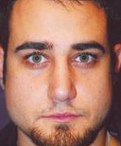 Male Facial Rejuvenation Before & After