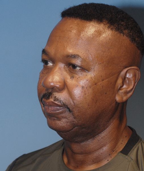 Male Facial Rejuvenation Before & After