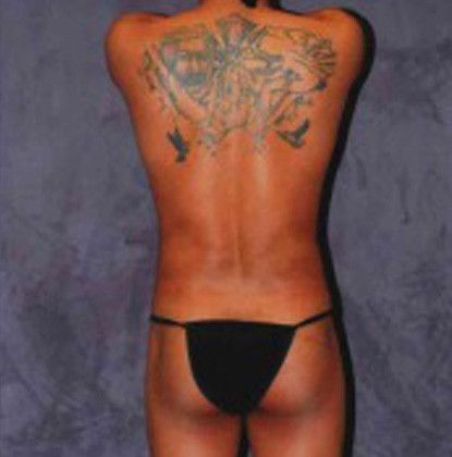 Male Body Contouring Before & After