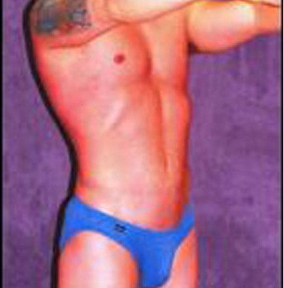 Male Body Contouring Before & After