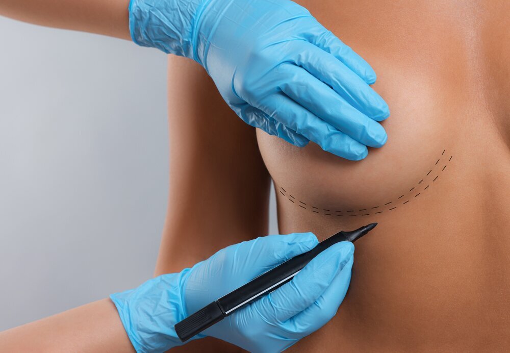 5 Common Myths of Plastic Surgery Disproven Houston
